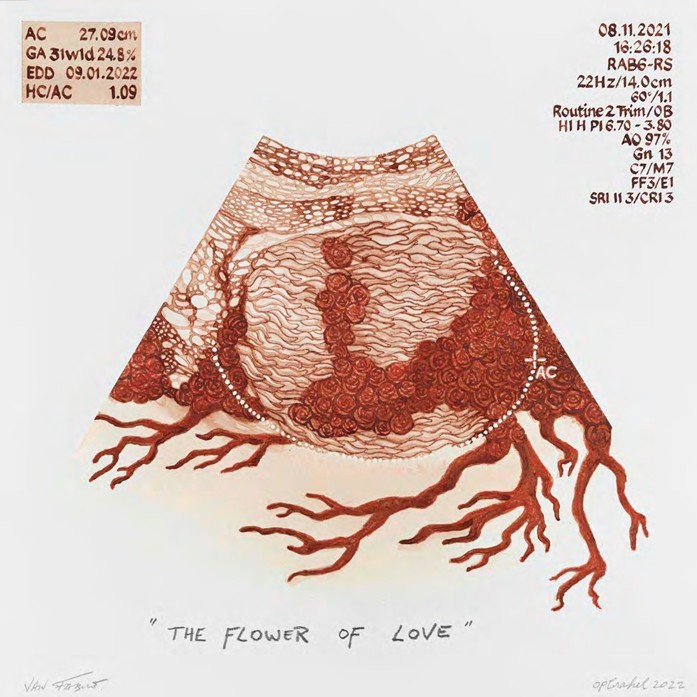 The flower of love