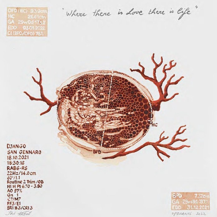 Where there is love there is life